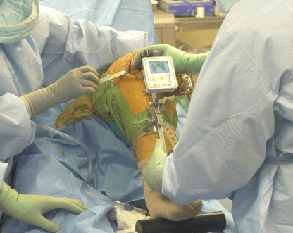 navigation assisted knee surgery